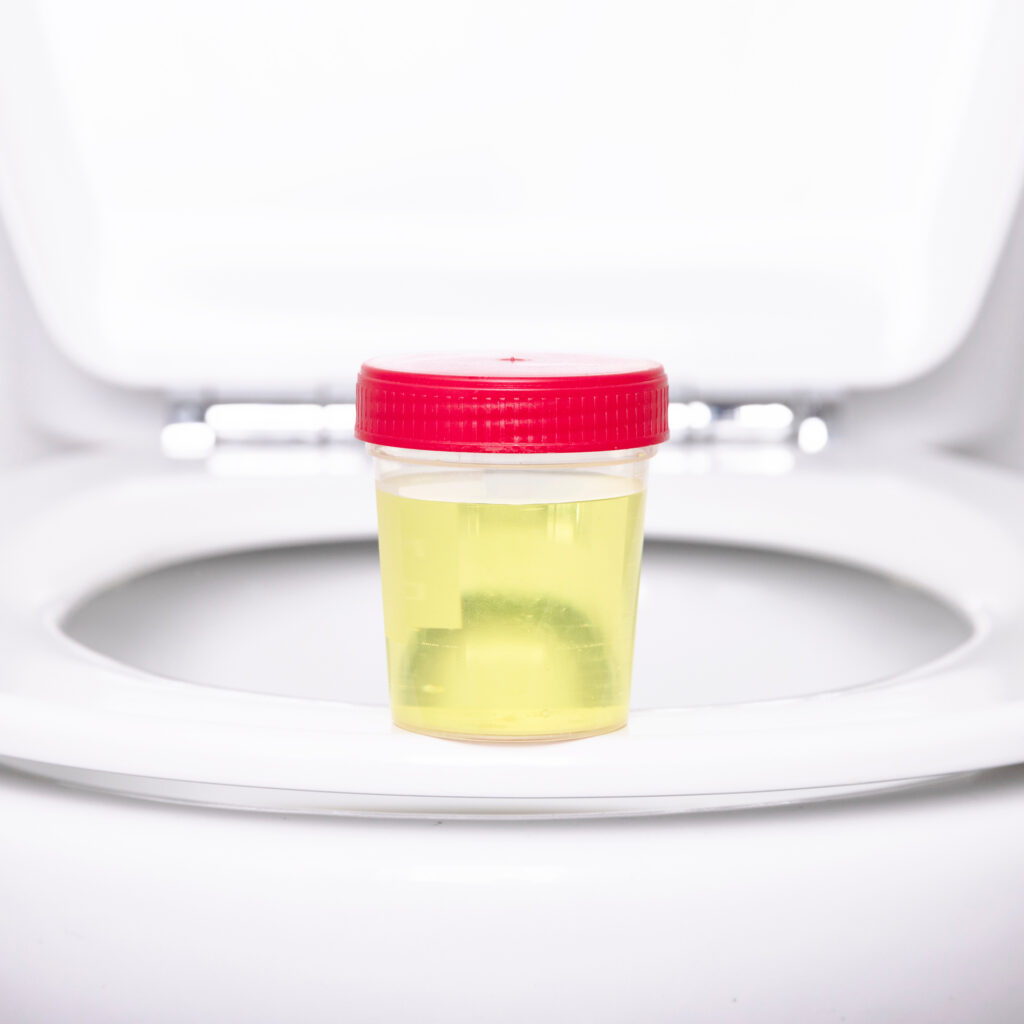 Das Spezimen Urin wird aufgrund der langen Nachweisbarkeit am häufigsten als Untersuchungsmaterial eingesetzt. Drogenscreenings in der Suchtstoffanalytik